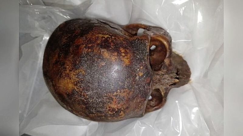 The decapitated head of &quot;The Crusader&quot; mummy, which has now been recovered after being stolen from a crypt at St Michan&#39;s Church in Dublin last month. Picture by Garda&iacute;, Press Association 