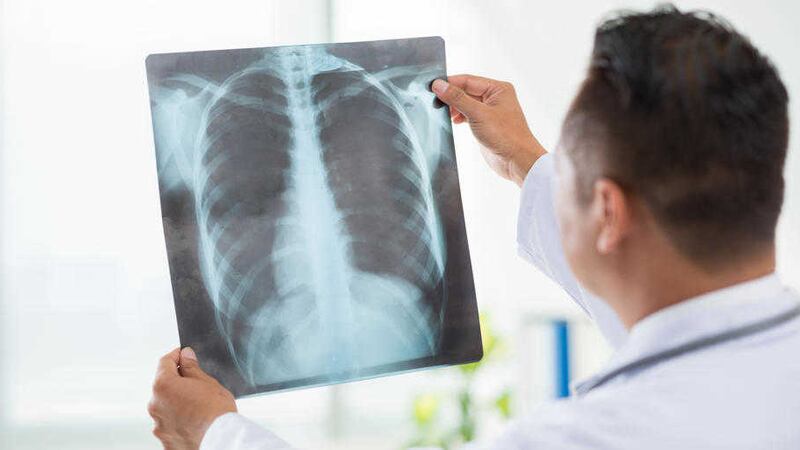 X-rays, as well as examinations, are needed before a pneumonia diagnosis is made 