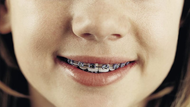 Braces can help to improve the position of teeth and positively enhance the growth of the facial bones 
