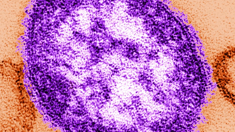 The Measles virus