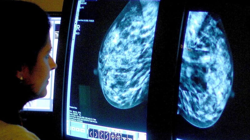 A new research project by two QUB academics will explore the inequality in outcomes for women diagnosed with breast cancer.
