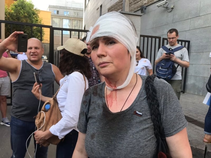 A woman who was struck by a police baton in Moscow