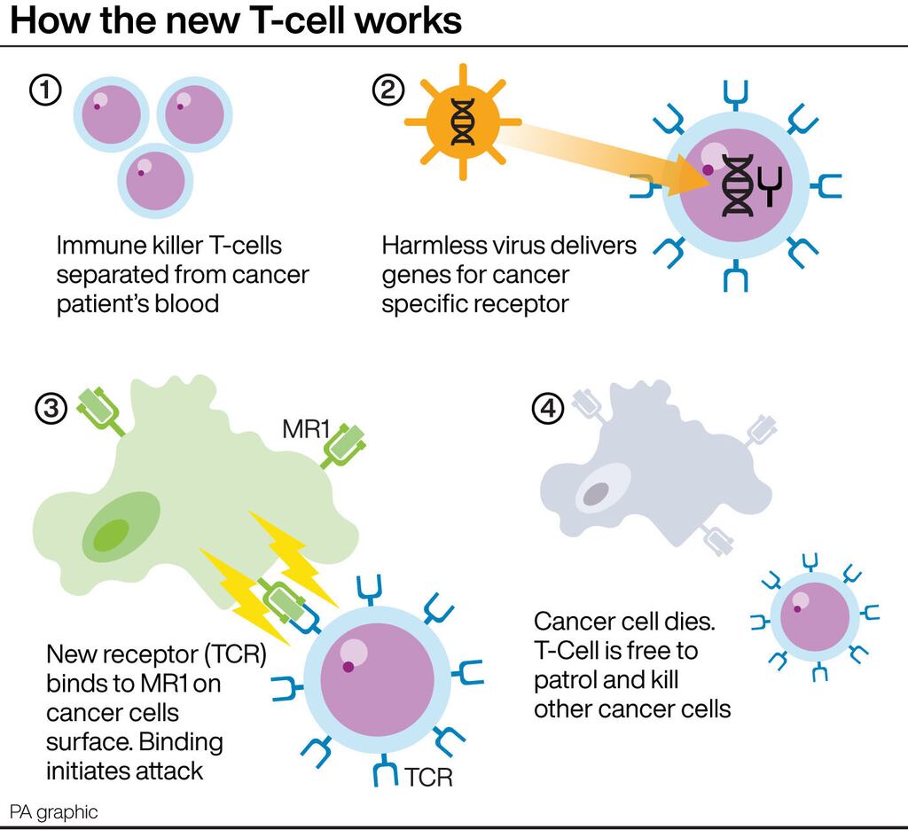 New T-cells ‘raise prospect of universal cancer therapy’ – The Irish News