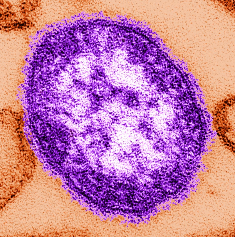 An image issued by the Centers for Disease Control and Prevention of the Measles virus