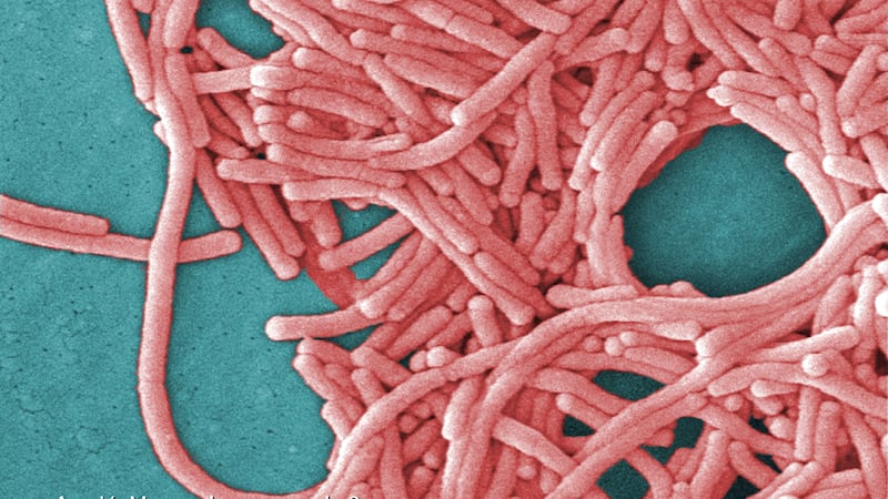 Legionella bacteria can lead to the serious lung disease, Legionnaires’ (Jance Haney Carr/Centers for Disease Control and Prevention)