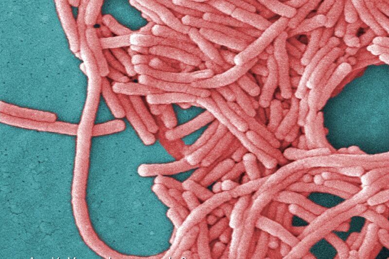 Legionella bacteria can cause serious lung disease that is fatal in 10% of cases