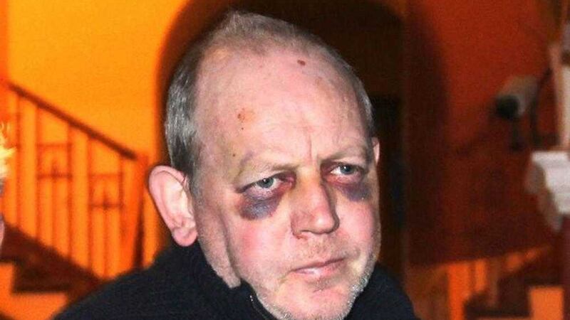 Pearse McAuley was arrested on Christmas Eve 2014 following the attack&nbsp;