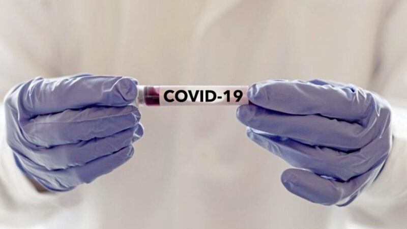 A further eight people who tested positive for Covid-19 have died in the Republic, it was announced on June 2 2020