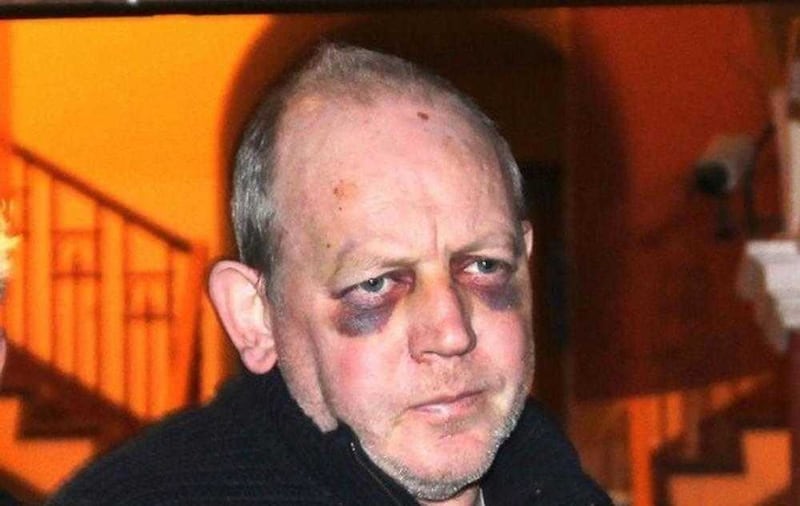 Pearse McAuley was arrested on Christmas Eve 2014 following the attack 