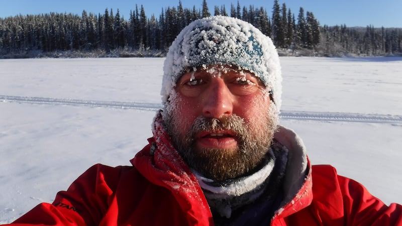 Nick Griffiths lost his toes after competing in the Yukon Arctic Ultra, an extreme winter race.