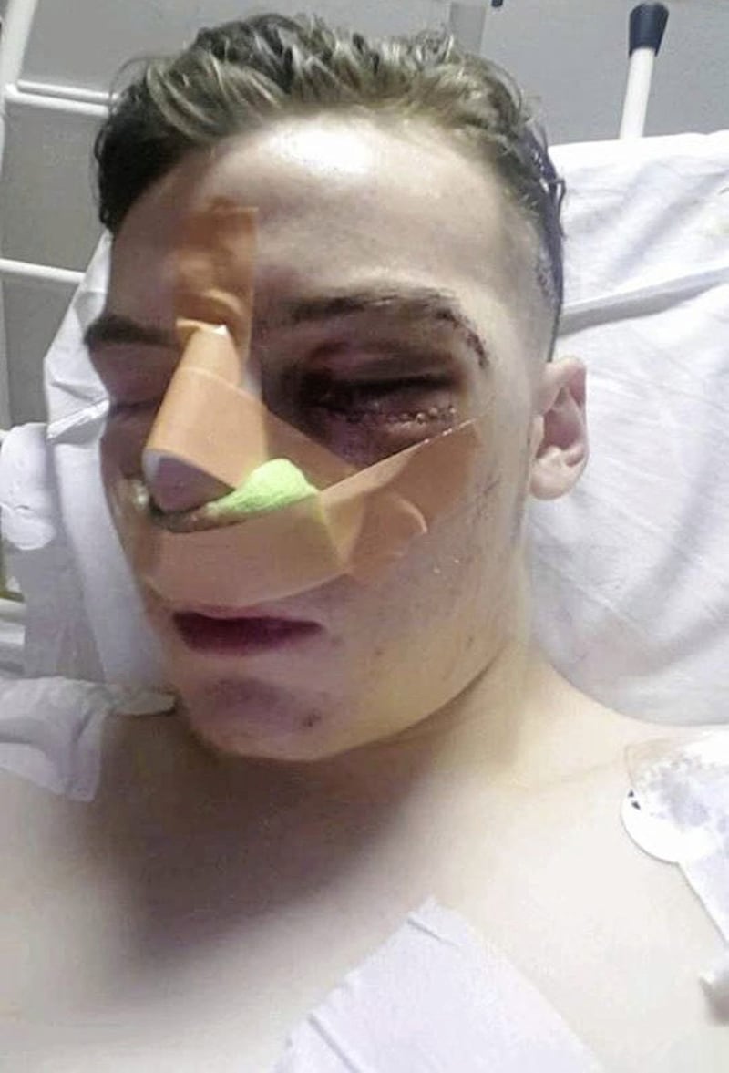 Jason Tuite (16), from Dundalk, suffered a catalogue of serious injuries when he was attacked outside a Vital gig on Boucher Road on August 26 