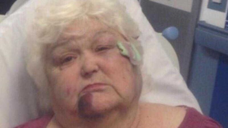 West Belfast pensioner Maureen Shepherd (76) was left with a broken jaw after being mugged by a teenager at the weekend