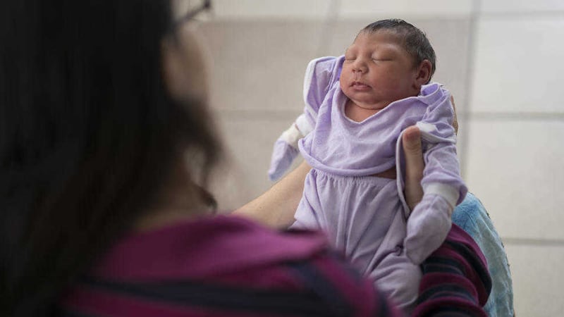 Cassiana Severino holds her daughter Melisa Vitoria, born with microcephaly in Brazil Picture byFelipe Dana, AP 