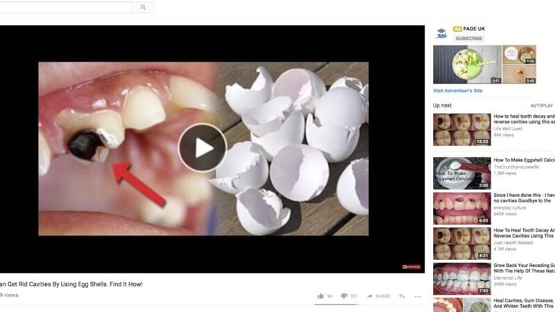 How to get rid of tooth cavities by... using eggshells. You&#39;d be much better advised to visit a dentist, though 