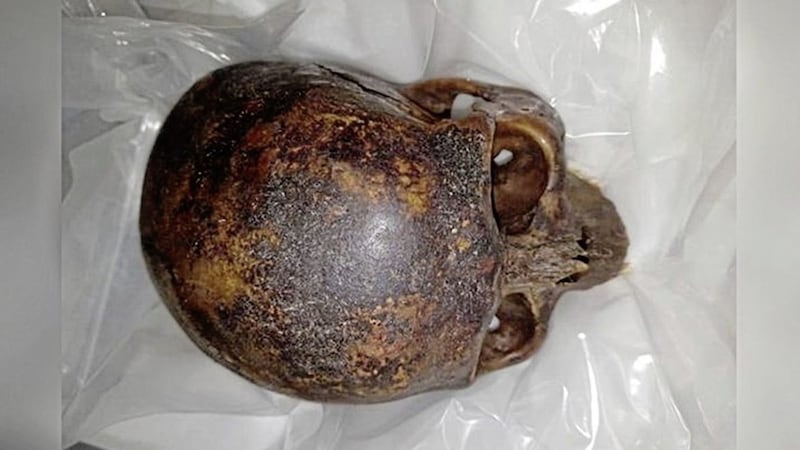 The decapitated head of &quot;The Crusader&quot; mummy, which was stolen from a crypt at St Michan&#39;s Church in Dublin earlier this year 