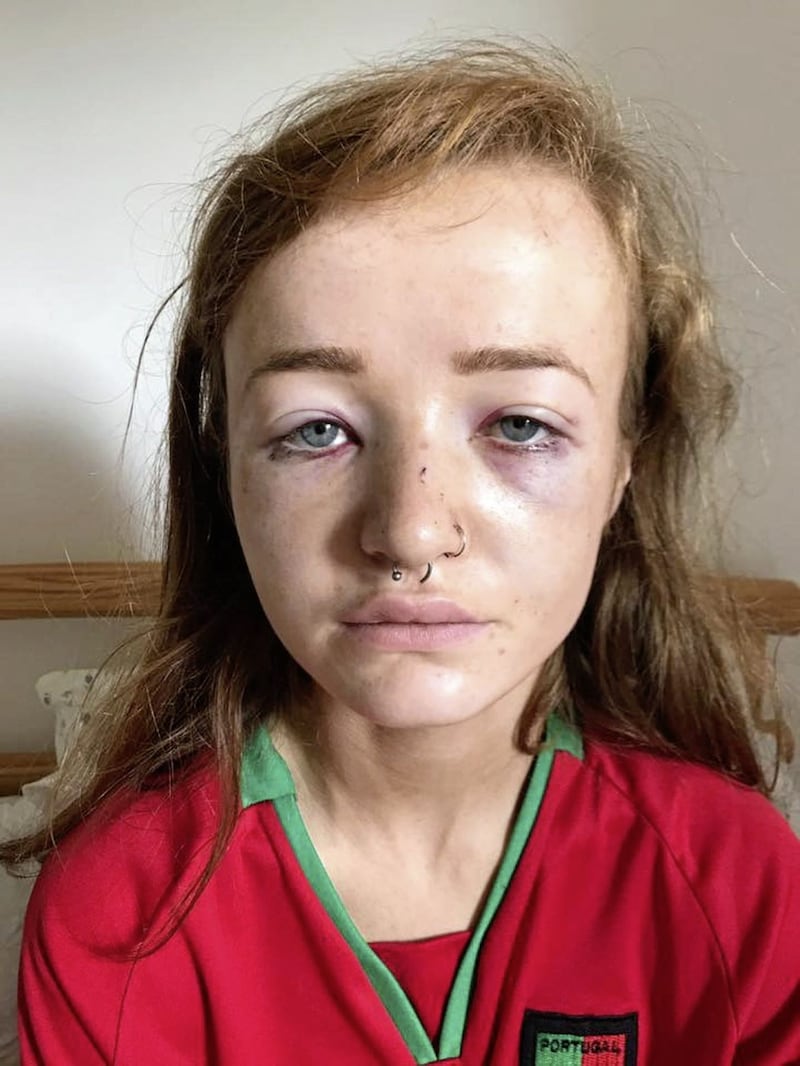 Donegal student Shanan Reid McDaid was on a night out with her boyfriend when she was attacked.  